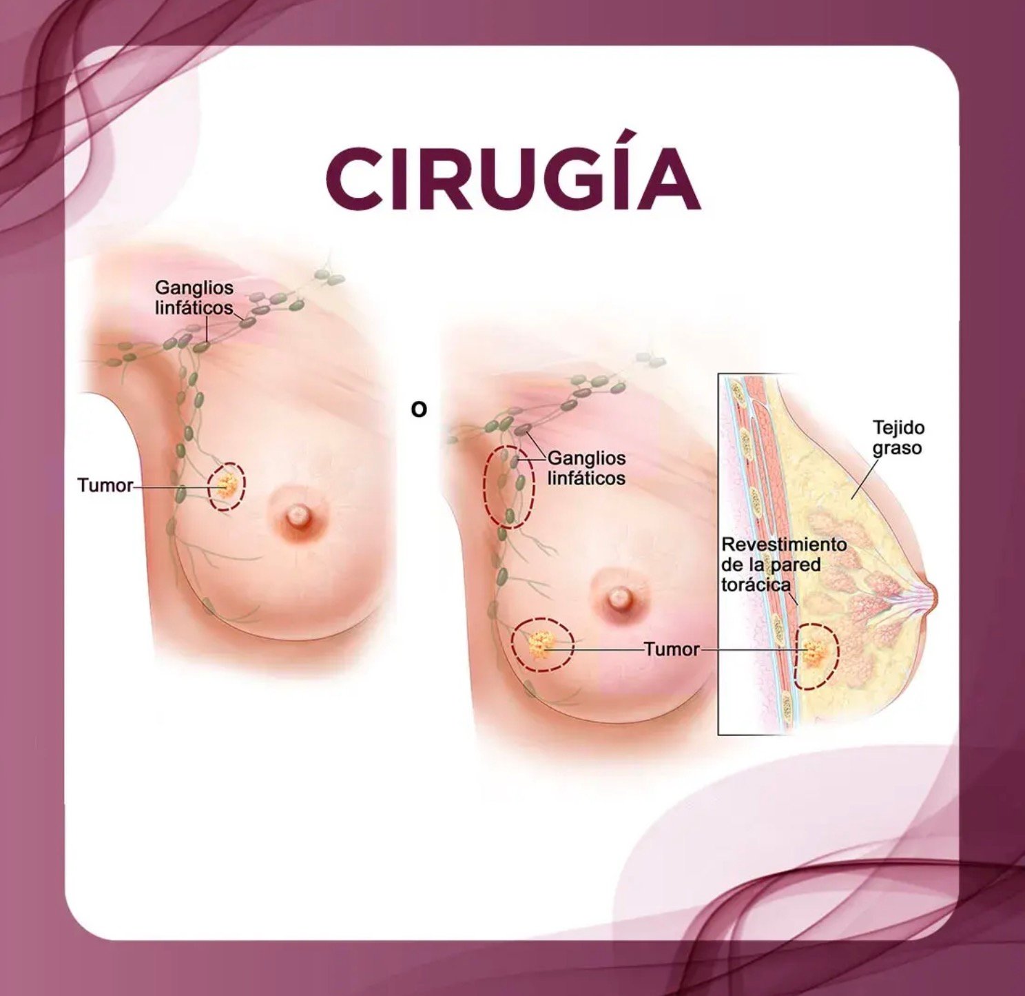 Criterios referencia oncología quirúrgica médicos