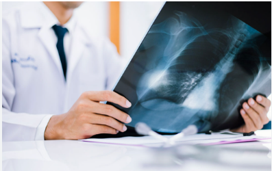 PET CT en oncología: cuándo está indicado